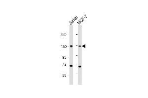 All lanes : Anti-CTCF Antibody (Center) at 1:2000 dilution Lane 1: Jurkat whole cell lysates Lane 2: MCF-7 whole cell lysates Lysates/proteins at 20 μg per lane. (CTCF anticorps  (AA 334-364))