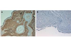 Immunohistochemistry of Rabbit Anti-Collagen Type I Antibody.