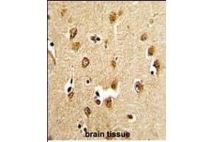 Formalin-fixed and paraffin-embedded human brain tissue reacted with ABI1 Antibody (N-term), which was peroxidase-conjugated to the secondary antibody, followed by DAB staining.
