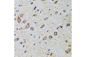 Immunohistochemistry of paraffin-embedded mouse brain using CDK1 antibody.