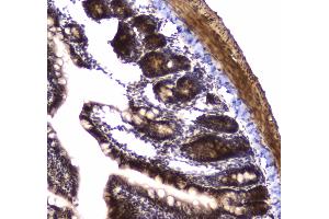 IHC analysis of POLR2A using anti-POLR2A antibody .