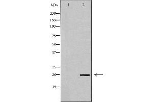 Western blot analysis of HeLa cell lysate, using BTC Antibody.