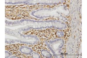 Immunoperoxidase of monoclonal antibody to TRIM16 on formalin-fixed paraffin-embedded human small Intestine. (TRIM16 anticorps  (AA 165-273))