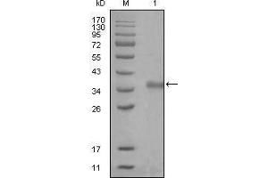 Western blot analysis using NCOR1 mouse mAb against truncated Trx-NCOR1 recombinant protein (1). (NCOR1 anticorps  (AA 1-192))
