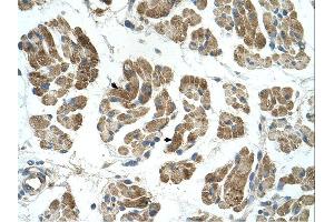 RHOT1 antibody was used for immunohistochemistry at a concentration of 4-8 ug/ml.