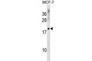 Western Blotting (WB) image for anti-CKLF-Like MARVEL Transmembrane Domain Containing 5 (CMTM5) antibody (ABIN2999517) (CMTM5 anticorps)