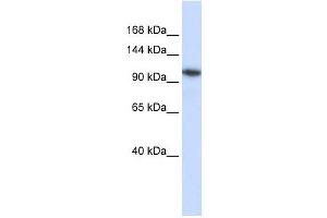 B4GALNT3 antibody used at 1 ug/ml to detect target protein. (B4GALNT3 anticorps  (N-Term))