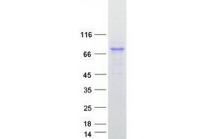 Validation with Western Blot