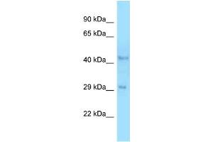 WB Suggested Anti-B4galt3 Antibody   Titration: 1. (B4GALT3 anticorps  (C-Term))