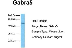 Host: Rabbit Target Name: Gabra5 Sample Tissue: Mouse Liver Antibody Dilution: 1. (GABRA5 anticorps  (Middle Region))