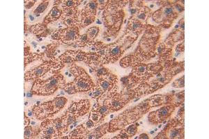 Used in DAB staining on fromalin fixed paraffin- embedded liver tissue
