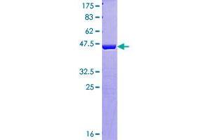 Image no. 1 for Hematological and Neurological Expressed 1-Like (HN1L) (AA 1-190) protein (GST tag) (ABIN1306848)