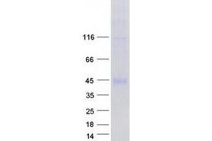 Validation with Western Blot