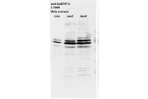 Image no. 2 for anti-Heterogeneous Nuclear Ribonucleoprotein L (HNRNPL) antibody (ABIN108589) (HNRNPL anticorps)