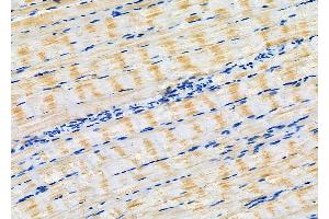 ABIN6266160 and ABIN6277132 at 1/100 staining Rat muscle tissue by IHC-P. (PIWIL1 anticorps  (Internal Region))