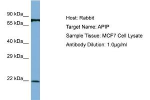 Host: Rabbit Target Name: APIP Sample Type: MCF7 Whole Cell lysates Antibody Dilution: 1. (APIP anticorps  (N-Term))