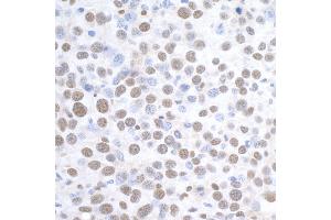 anti-DEAD (Asp-Glu-Ala-Asp) Box Polypeptide 1 (DDX1) (C-Term) antibody