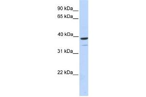 WB Suggested Anti-TRIM27 Antibody Titration:  0. (TRIM27 anticorps  (Middle Region))
