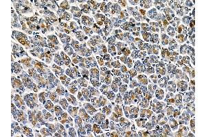 anti-F-Box and Leucine-Rich Repeat Protein 12 (FBXL12) antibody