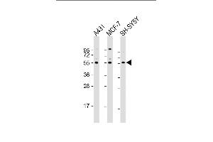All lanes : Anti-NEK3 Antibody  at 1:2000 dilution Lane 1: A431 whole cell lysate Lane 2: MCF-7 whole cell lysate Lane 3: SH-SY5Y whole cell lysate Lysates/proteins at 20 μg per lane.
