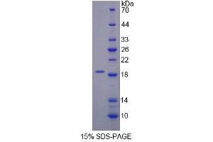 SDS-PAGE analysis of Human DARS Protein. (DARS Protéine)