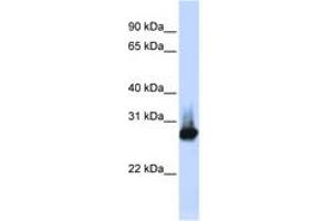 Image no. 1 for anti-B-Cell Receptor-Associated Protein 31 (BCAP31) (C-Term) antibody (ABIN6749735) (BCAP31 anticorps  (C-Term))