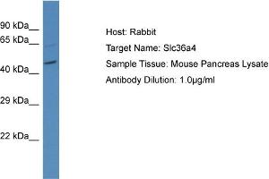 Host: Rabbit Target Name: SLC36A4 Sample Tissue: Mouse Pancreas Antibody Dilution: 1ug/ml (SLC36A4 anticorps  (N-Term))