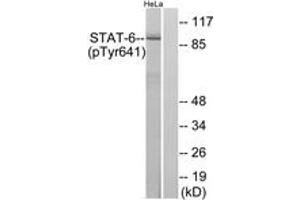 Western blot analysis of extracts from HeLa cells treated with IL-4, using STAT6 (Phospho-Tyr641) Antibody. (STAT6 anticorps  (pTyr641))