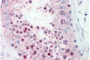 Anti-SLITRK6 antibody  ABIN960818 IHC staining of human testis. (SLITRK6 anticorps  (Cytoplasmic Domain))