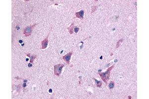 Anti-QRFPR / GPR103 antibody IHC of human brain, neurons and glia.