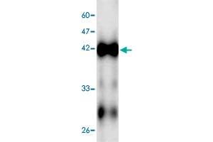 Western blot analysis in ECs2841 recombinant protein with ECs2841 monoclonal antibody, clone 5f4s6  at 1 : 1000 dilution. (ECs2841 anticorps  (AA 23-338))