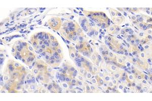 Detection of PIGR in Mouse Stomach Tissue using Polyclonal Antibody to Polymeric Immunoglobulin Receptor (PIGR)