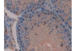 Detection of MAP2K2 in Mouse Testis Tissue using Polyclonal Antibody to Mitogen Activated Protein Kinase Kinase 2 (MAP2K2)