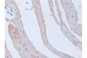 Detection of ITSN1 in Rat Heart Tissue using Polyclonal Antibody to Intersectin 1 (ITSN1)