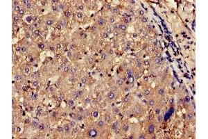 Immunohistochemistry of paraffin-embedded human liver tissue using ABIN7148445 at dilution of 1:100 (CNKSR2 anticorps  (AA 650-800))