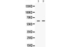 Western blot analysis of PAK3 expression in rat brain extract (lane 1) and mouse brain extract (lane 2).