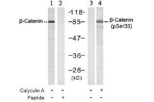 Image no. 3 for anti-Catenin (Cadherin-Associated Protein), beta 1, 88kDa (CTNNB1) (pSer33) antibody (ABIN196956) (CTNNB1 anticorps  (pSer33))