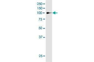 MAP3K13 monoclonal antibody (M04), clone 4H7.