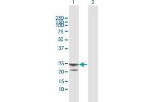 Western Blot analysis of ATP5O expression in transfected 293T cell line by ATP5O MaxPab polyclonal antibody. (ATP5O anticorps  (AA 1-213))