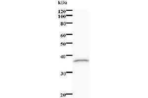 Western Blotting (WB) image for anti-ALX Homeobox 1 (ALX1) antibody (ABIN931200) (ALX1 anticorps)