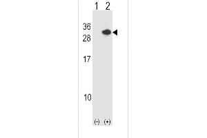Western blot analysis of RCAN1 using rabbit polyclonal RCAN1 Antibody using 293 cell lysates (2 ug/lane) either nontransfected (Lane 1) or transiently transfected (Lane 2) with the RCAN1 gene.