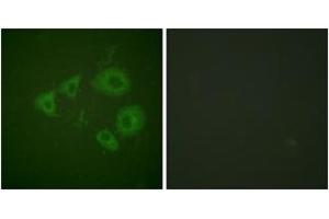 Immunofluorescence analysis of HuvEc cells, using Trk B (Phospho-Tyr705) Antibody. (TRKB anticorps  (pTyr706))