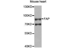 Western blot analysis of extracts of Mouse heart cell line, using FAP antibody. (FAP anticorps)