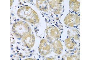 Immunohistochemistry of paraffin-embedded Human stomach using FBXL5 Polyclonal Antibody at dilution of 1:100 (40x lens).