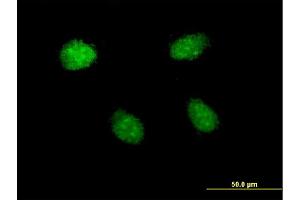 Immunofluorescence of monoclonal antibody to HEY1 on HeLa cell. (HEY1 anticorps  (AA 121-220))