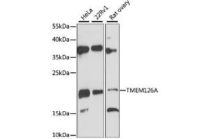 Western blot analysis of extracts of various cell lines, using TMEM126A antibody (ABIN6293944) at 1:3000 dilution.