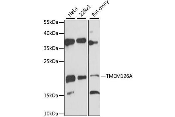 TMEM126A antibody