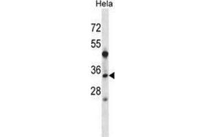 Western blot analysis in Hela cell line lysates (35ug/lane) using LAT2 / WBSCR15  Antibody . (LAT2 anticorps  (Middle Region))