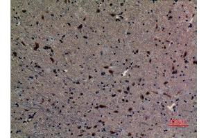 Immunohistochemistry (IHC) analysis of paraffin-embedded Mouse Brain, antibody was diluted at 1:100. (UBE2A/B (C-Term) anticorps)