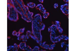IF analysis of HSD11B2 using anti-HSD11B2 antibody (ABIN7602698).